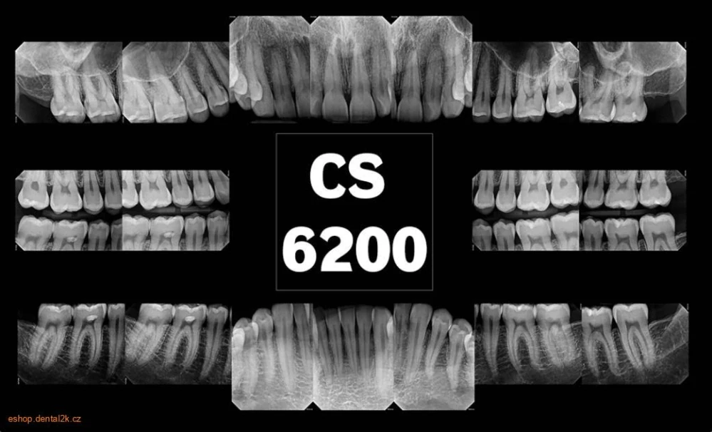 Carestream Dental CS 6200