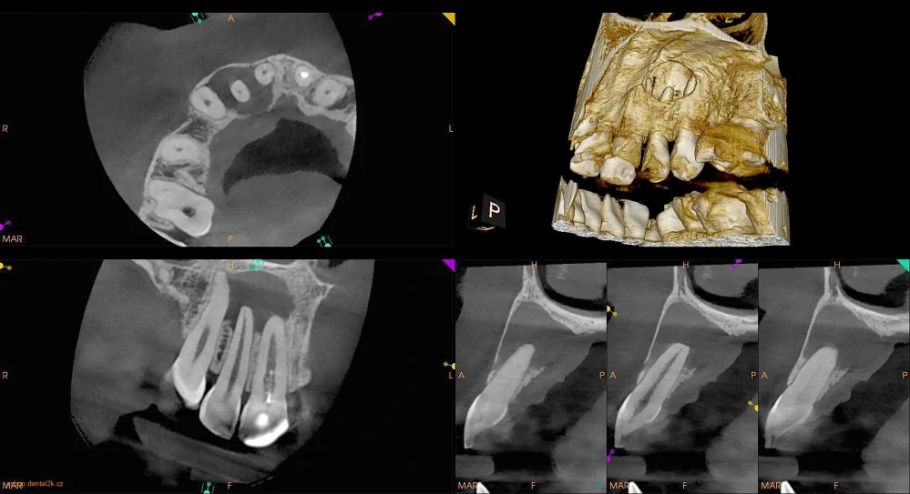 Carestream Dental CS 8200 3D Access