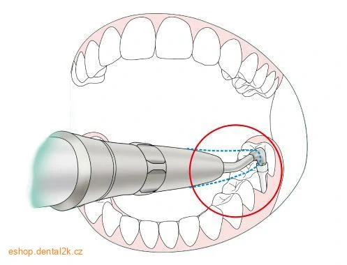 NSK Perio-Mate - typ NSK připojení