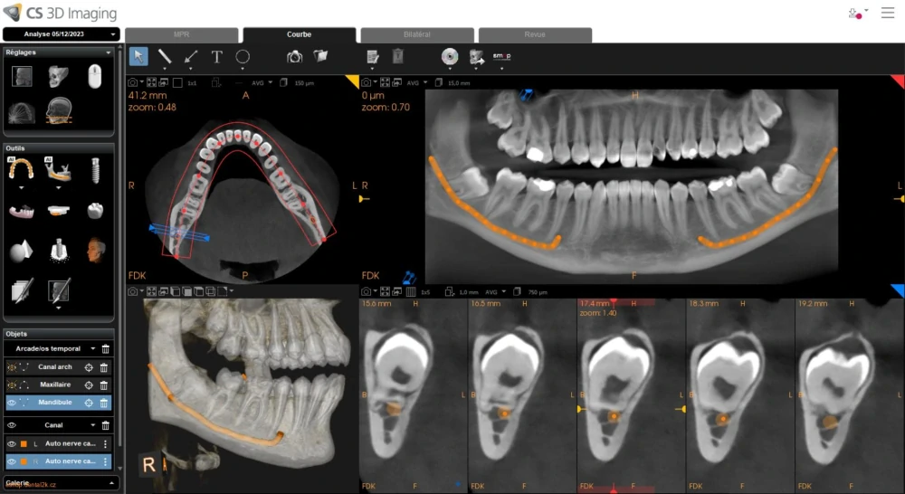 Carestream Dental CS 8200 3D Access