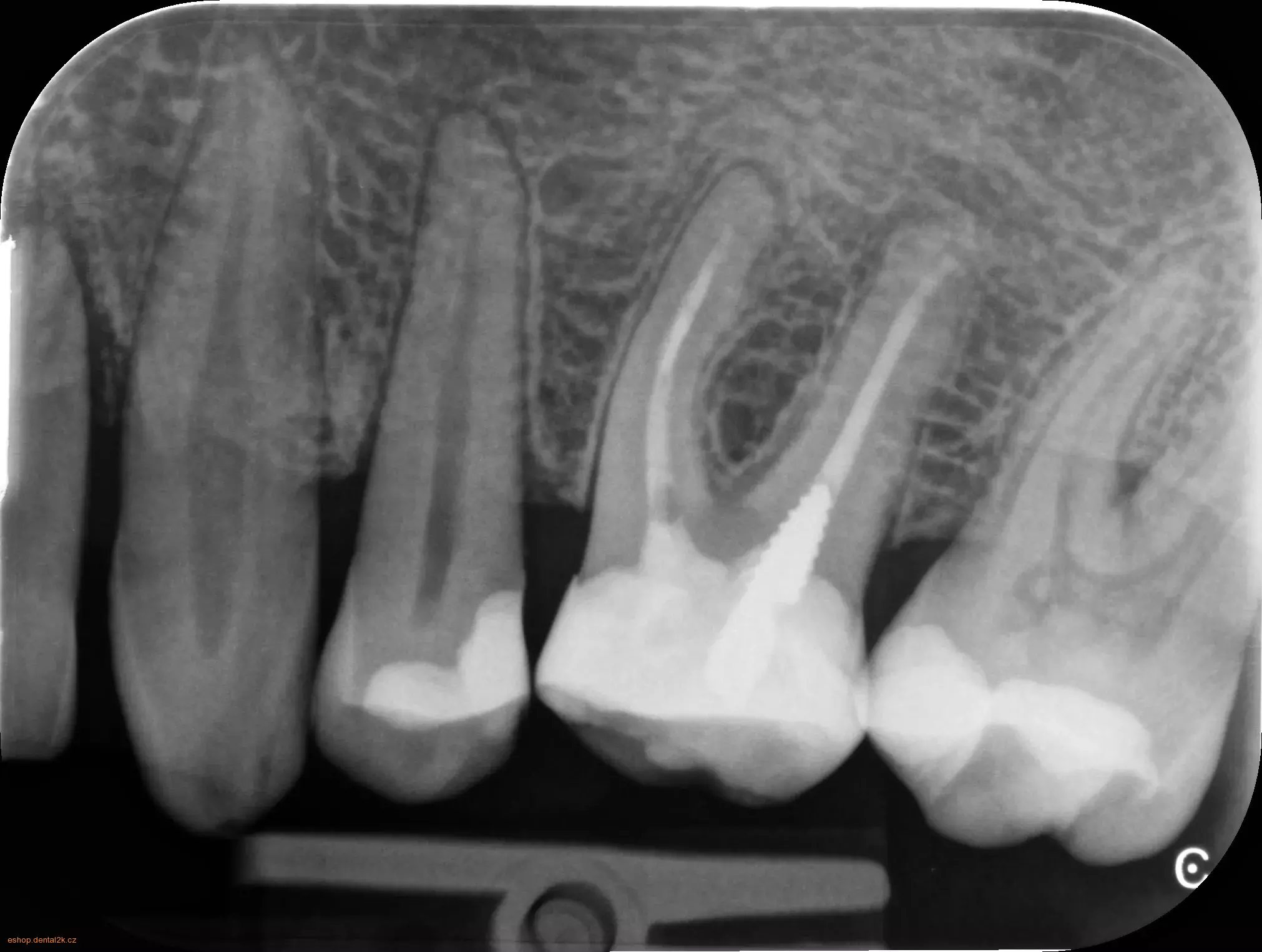 Carestream Dental CS 7600