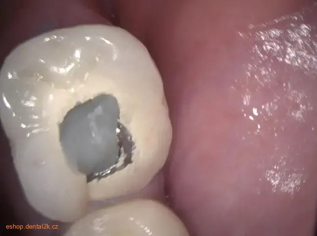 Carestream Dental CS 1200