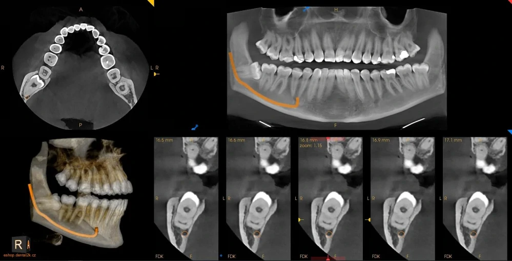 Carestream Dental CS 8200 3D Access