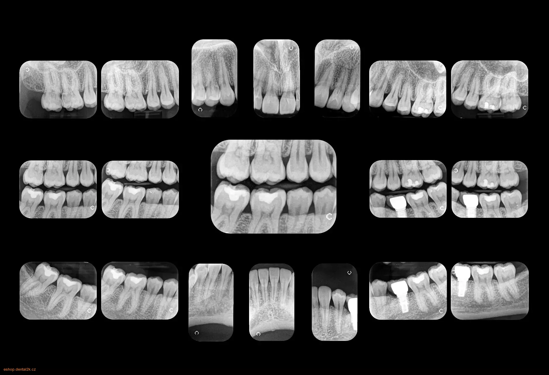 Carestream Dental CS 7600