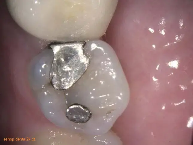 Carestream Dental CS 1200