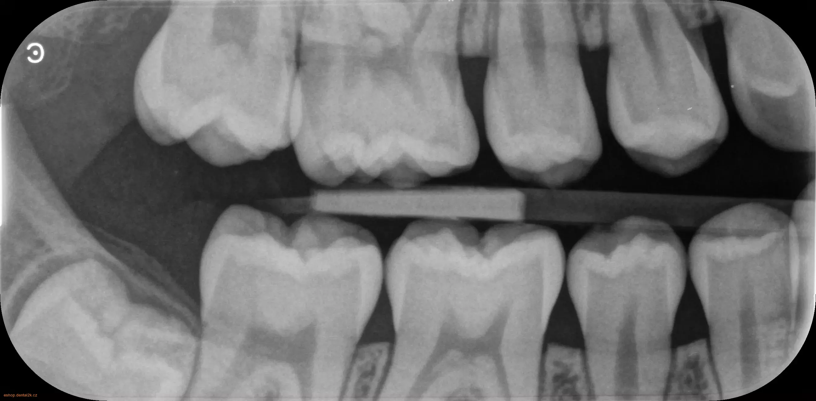 Carestream Dental CS 7600