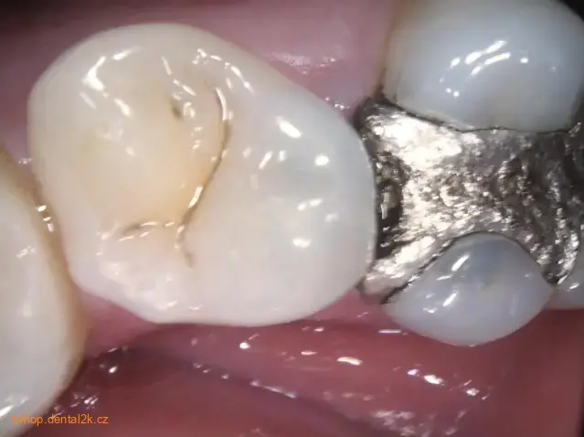 Carestream Dental CS 1200