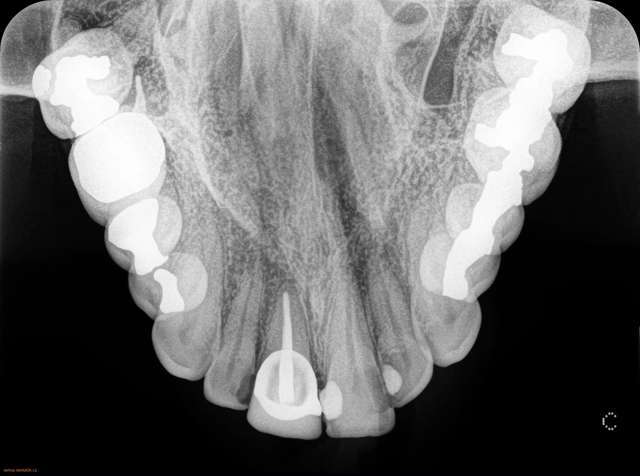 Carestream Dental CS 7600
